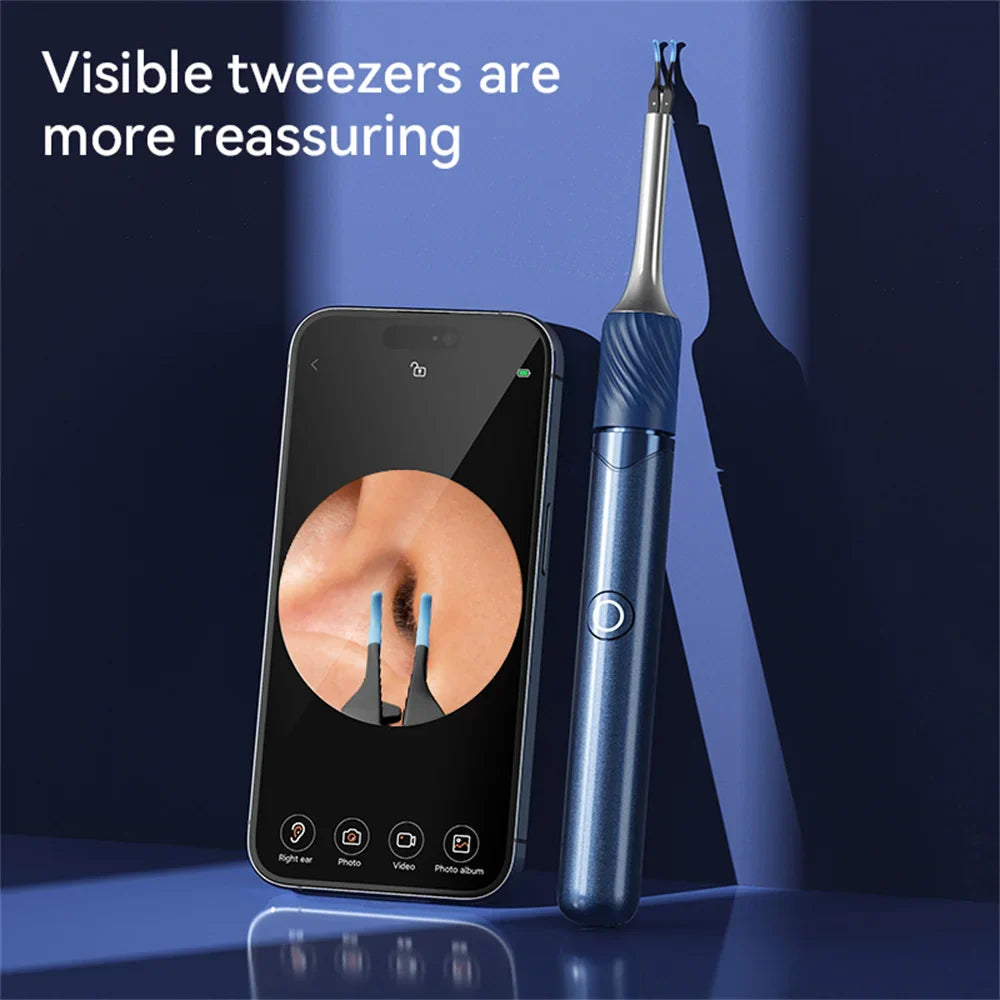 WiFi 3-in-1 Ear Otoscope- HD Camera 360° Precision Robotic Tweezer & Gentle Silicone Earpick