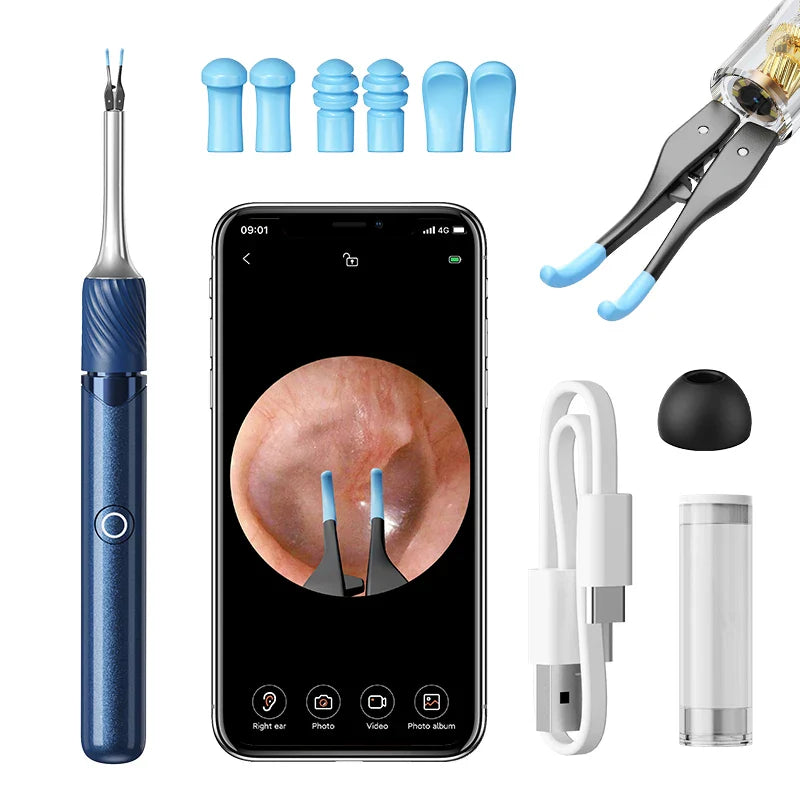 WiFi 3-in-1 Ear Otoscope- HD Camera 360° Precision Robotic Tweezer & Gentle Silicone Earpick