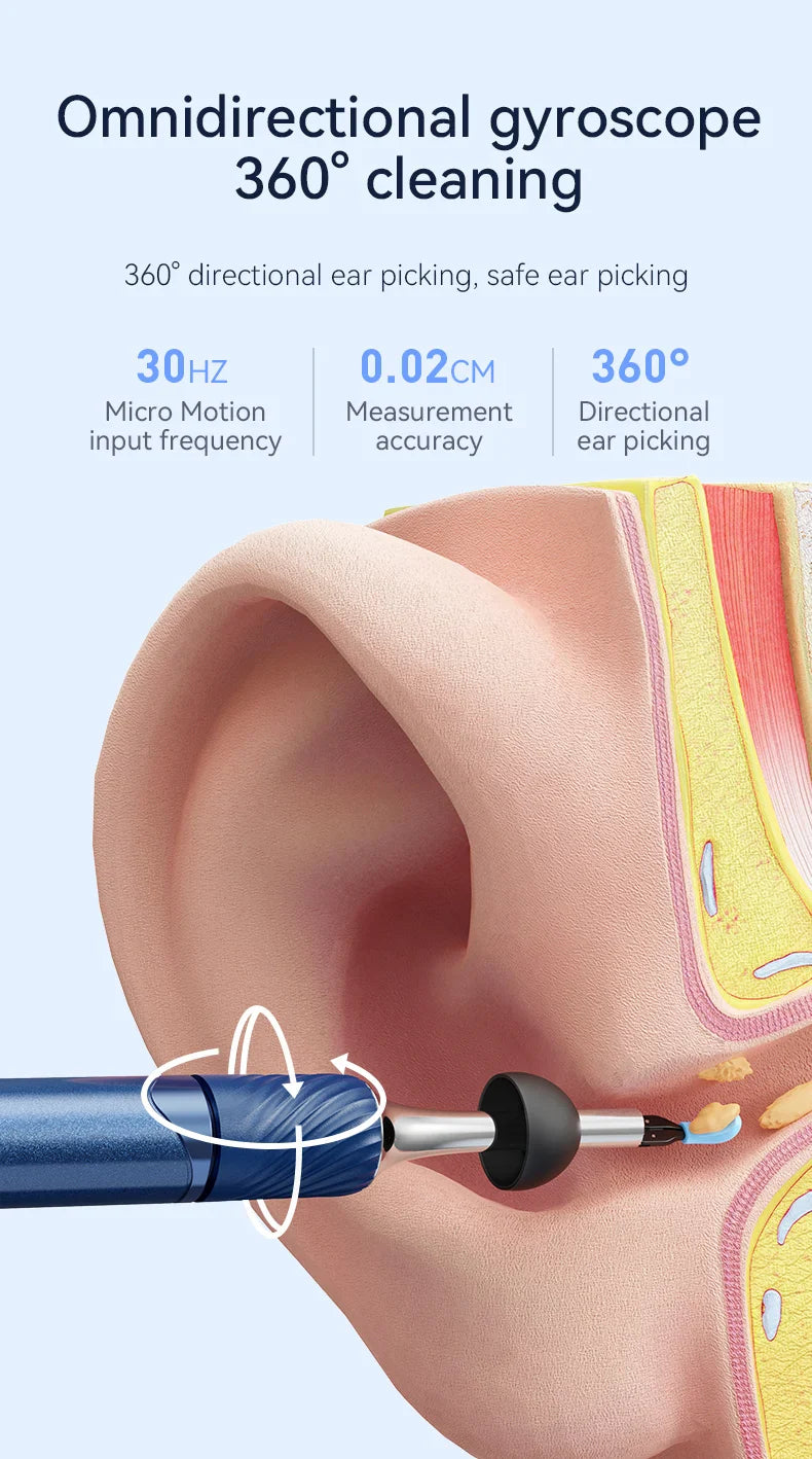 WiFi 3-in-1 Ear Otoscope- HD Camera 360° Precision Robotic Tweezer & Gentle Silicone Earpick