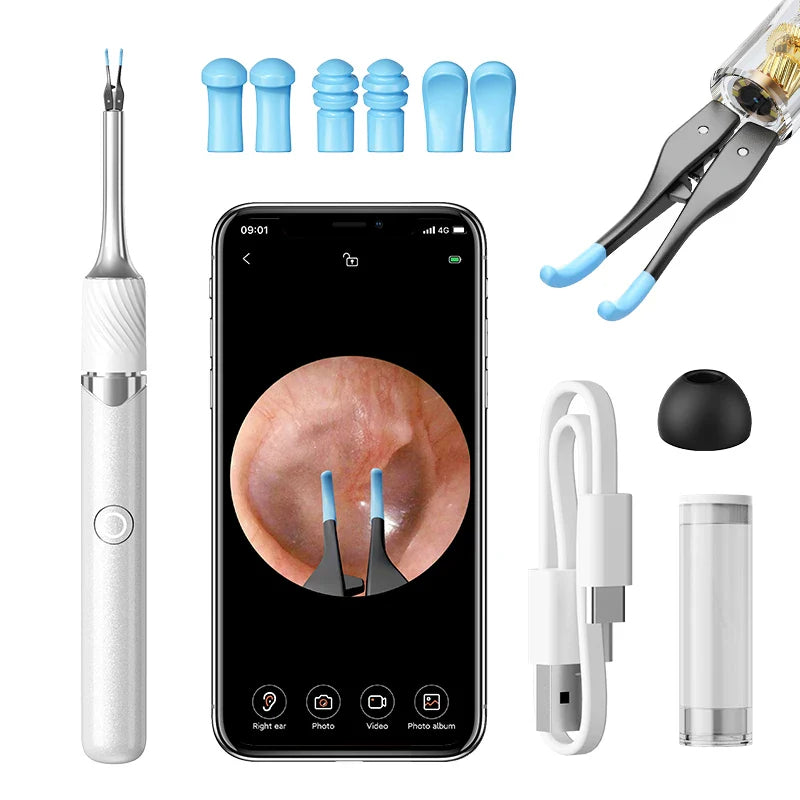 WiFi 3-in-1 Ear Otoscope- HD Camera 360° Precision Robotic Tweezer & Gentle Silicone Earpick