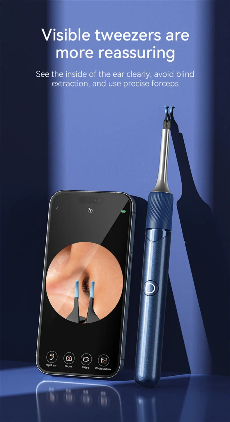 WiFi 3-in-1 Ear Otoscope- HD Camera 360° Precision Robotic Tweezer & Gentle Silicone Earpick