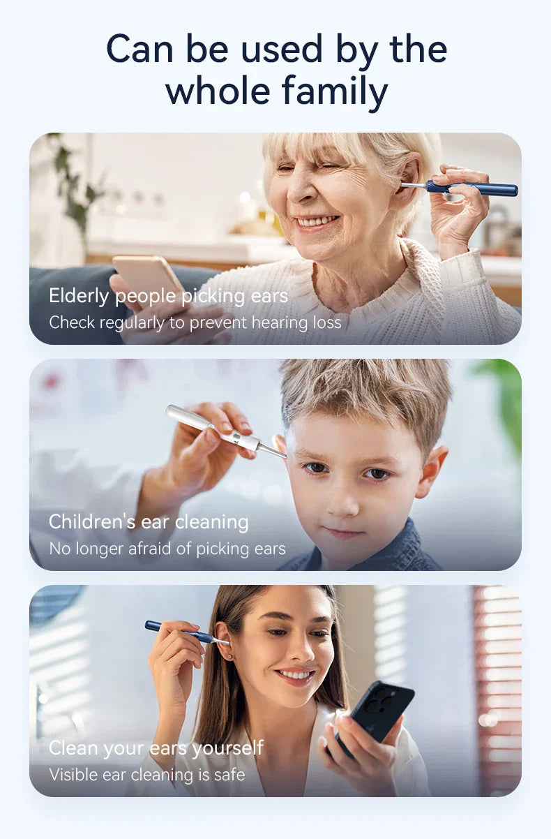 WiFi 3-in-1 Ear Otoscope- HD Camera 360° Precision Robotic Tweezer & Gentle Silicone Earpick