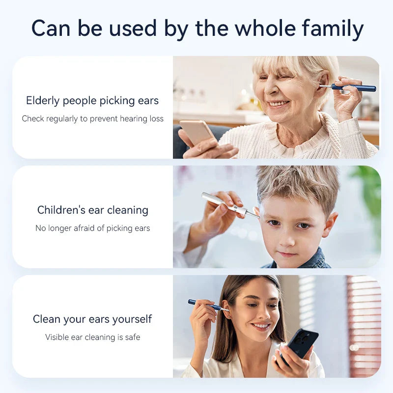 WiFi 3-in-1 Ear Otoscope- HD Camera 360° Precision Robotic Tweezer & Gentle Silicone Earpick