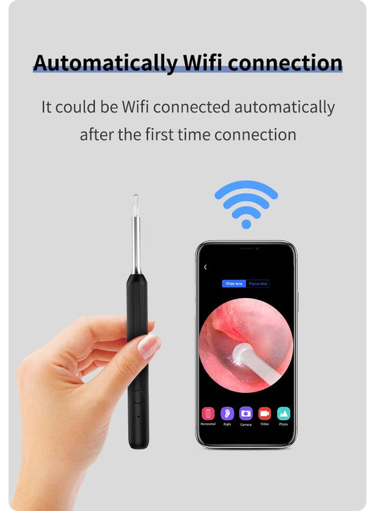 Ear Endoscope HD Camera for iPhone & Android