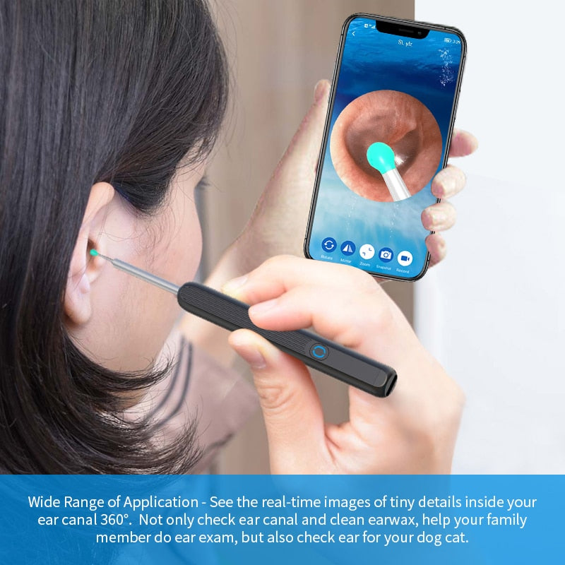 NE3™ Wireless 1080P HD Smart Wifi Ear Cleaning Otoscope