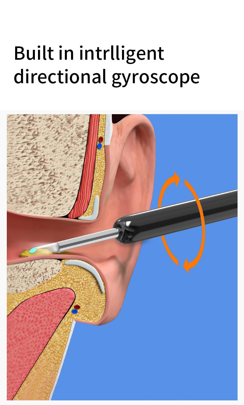 NE3™ Wireless 1080P HD Smart Wifi Ear Cleaning Otoscope