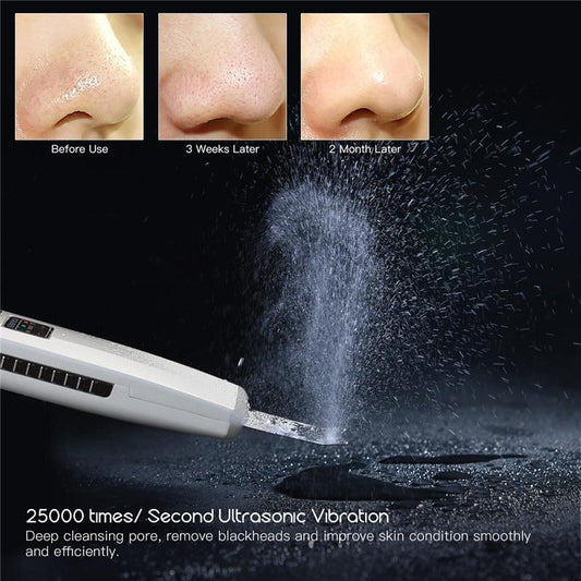 ScrubTech™ Ultrasonic Skin Facial Cleanser - Indigo-Temple