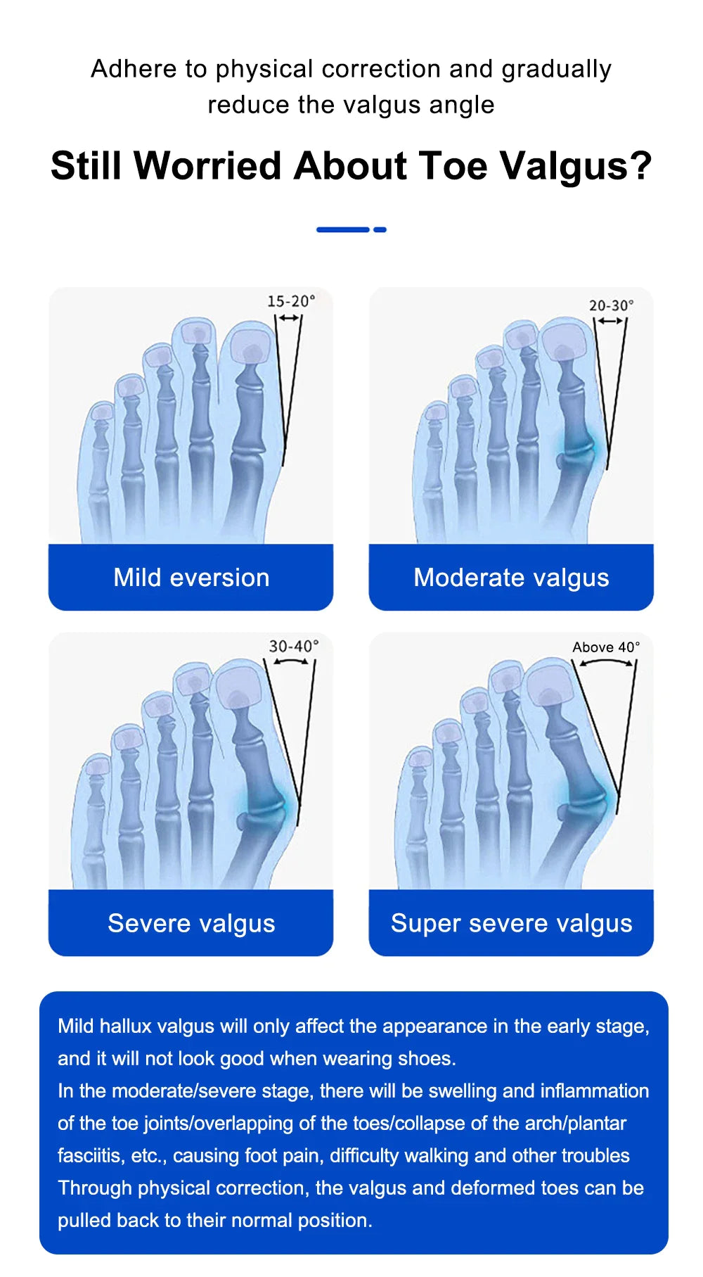 AngleFlex - 180° Rotation Orthopedic Bunion Splint  Corrector