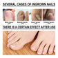 Ingrown Toenail Treatment Softener Serum