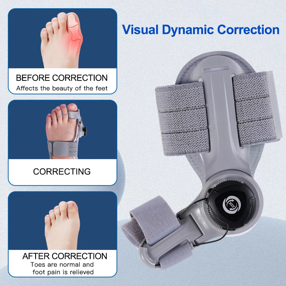 AngleFlex - 180° Rotation Orthopedic Bunion Splint  Corrector