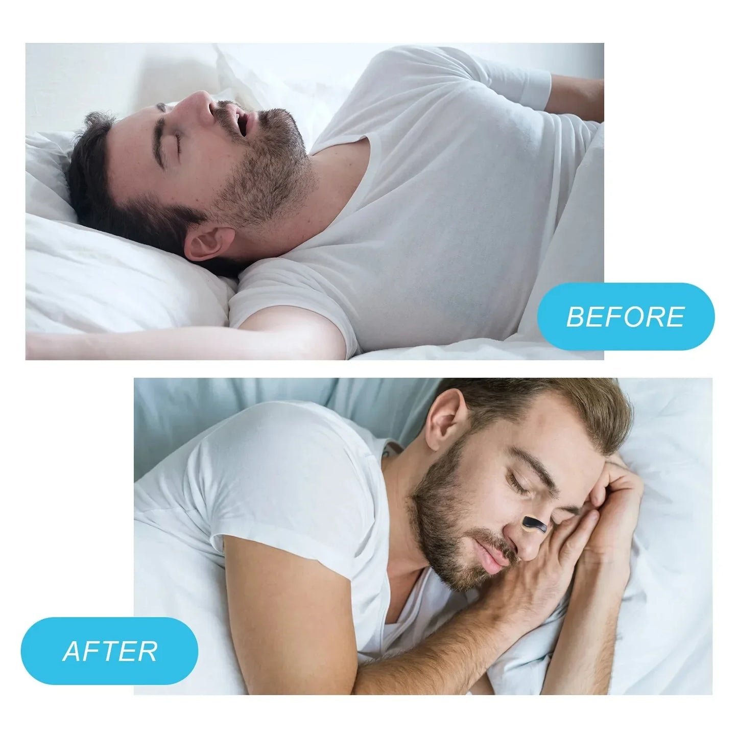 Smart Magnetic Nasal Breathing Dilators for Snoring Relief and Airflow Support