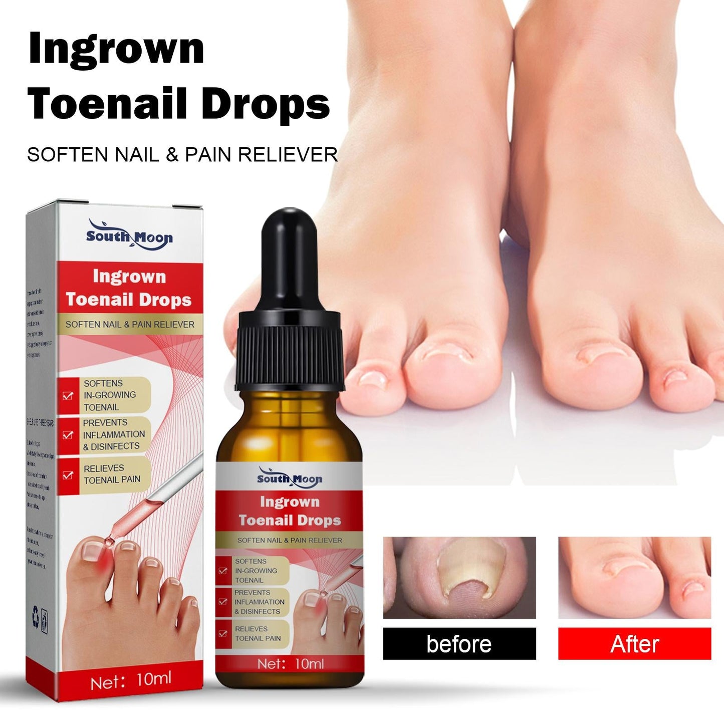 Ingrown Toenail Treatment Softener Serum