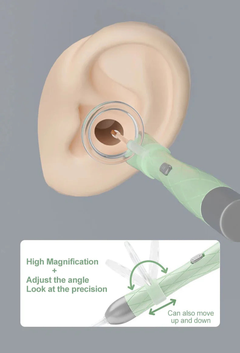 Extra-Safe Family Ear Cleaning Kit with LED Light, Magnifier, Tweezers & Multiple Spoon Heads