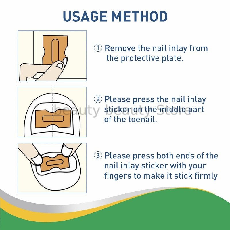 Ingrown Toenail Correction / Pain Relieve Stickers (50 pcs)