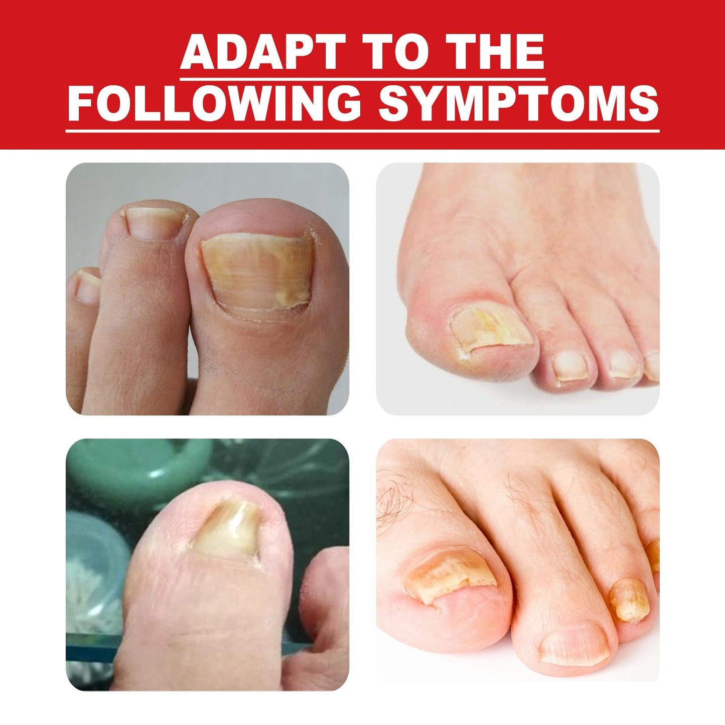 Ingrown Toenail Treatment Softener Serum