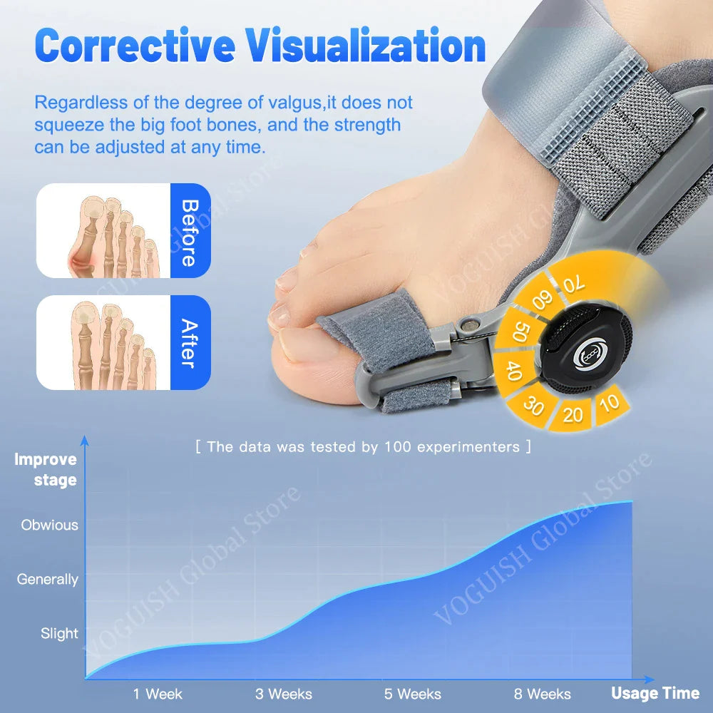 AngleFlex - 180° Rotation Orthopedic Bunion Splint  Corrector