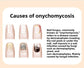 Rechargeable Infrared + Blue Light Fingernails & Toenails Fungus Treatment Device