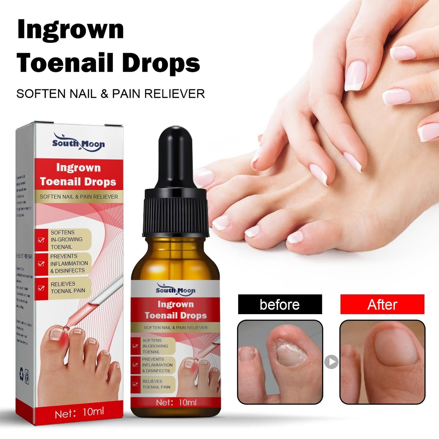 Ingrown Toenail Treatment Softener Serum