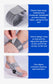 AngleFlex - 180° Rotation Orthopedic Bunion Splint  Corrector