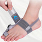 AngleFlex - 180° Rotation Orthopedic Bunion Splint  Corrector