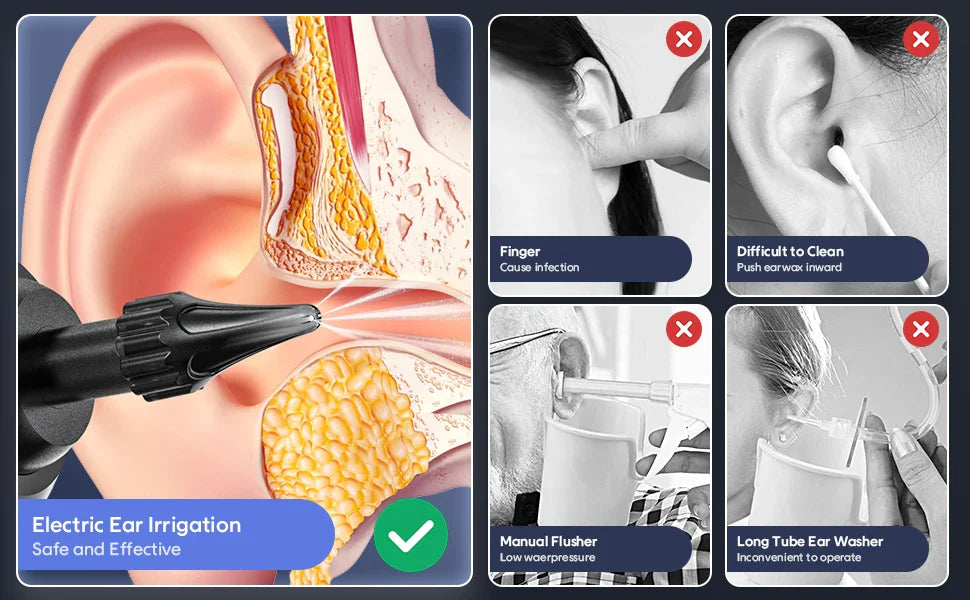Electric Rechargeable 4 Pressure Modes Ear Wax Removal