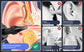 Electric Rechargeable 4 Pressure Modes Ear Wax Removal