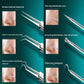 Professional Ultra-fine No. 5 Face Deep Cleaning Set