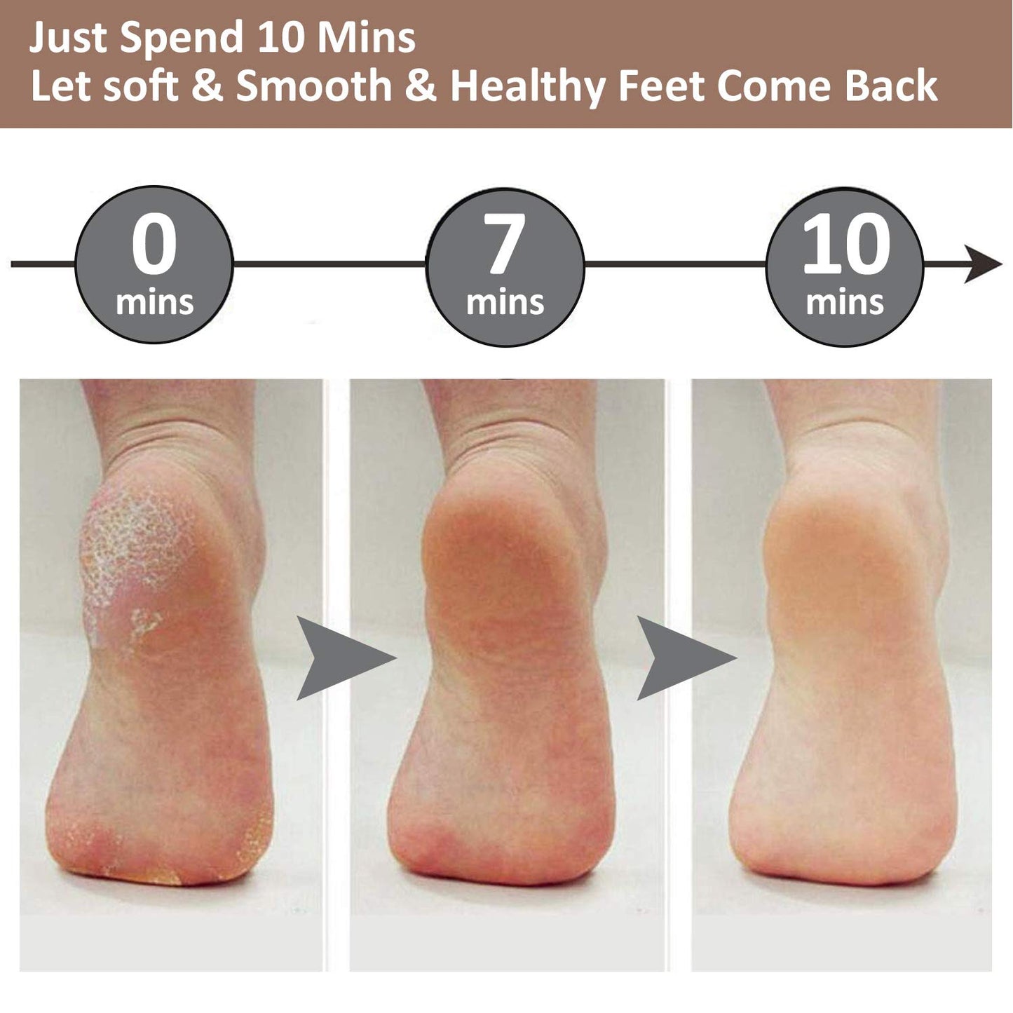 Rechargeable Electric Foot Callus Remover