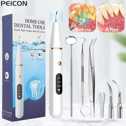 Ultrasonic Dental Stain and Plaque Remover