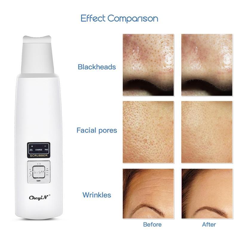 ScrubTech™   Ultrasonic Skin Facial Cleanser - Indigo-Temple