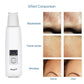 ScrubTech™   Ultrasonic Skin Facial Cleanser - Indigo-Temple