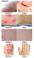 All-Natural Asian Herbal Eczema Treatment Cream
