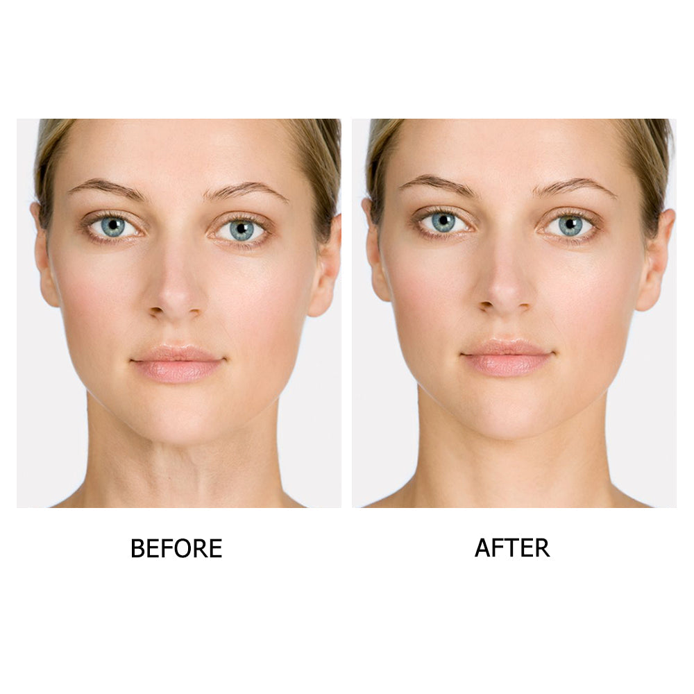 Timeless™ Reusable Anti-Wrinkles Silicone Patches