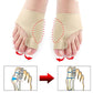Cozy Bunion Correction Socks (2pcs)