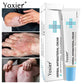 All-Natural Asian Herbal Eczema Treatment Cream