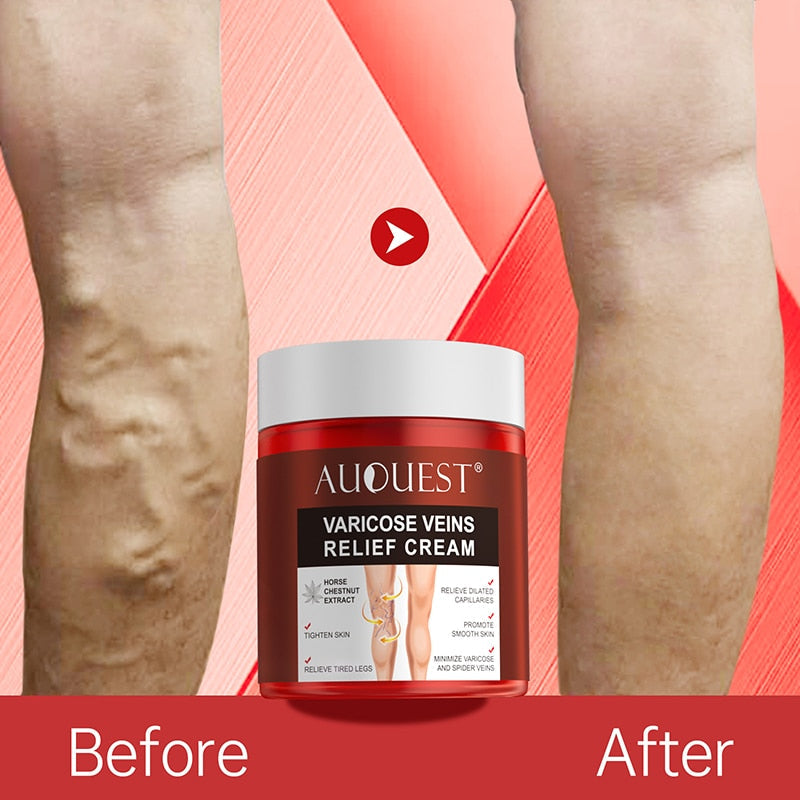 AUQUEST™ Varicose Veins Relief Cream