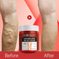 AUQUEST™ Varicose Veins Relief Cream